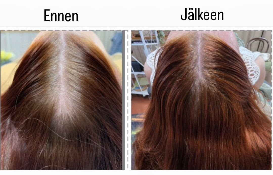 Green Peel Hairboost hoito Hyvän Olon Aitta kauneushoitola Hämeenlinna.